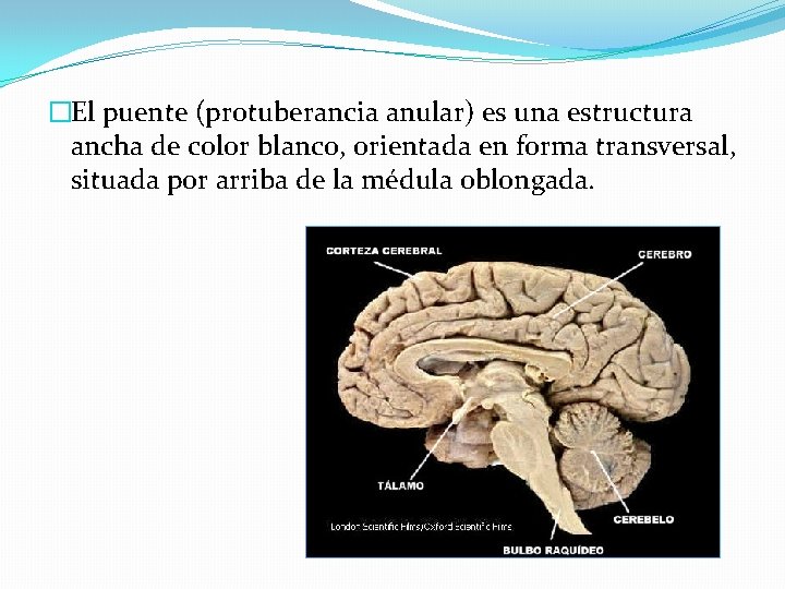 �El puente (protuberancia anular) es una estructura ancha de color blanco, orientada en forma