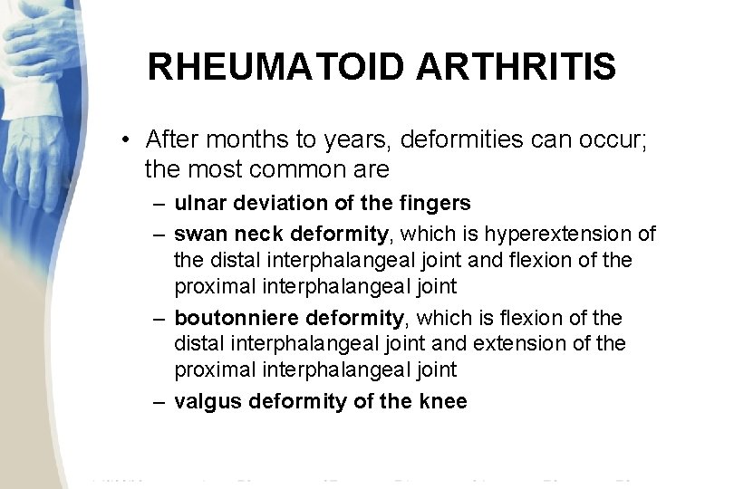 RHEUMATOID ARTHRITIS • After months to years, deformities can occur; the most common are