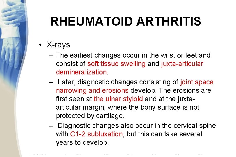 RHEUMATOID ARTHRITIS • X-rays – The earliest changes occur in the wrist or feet