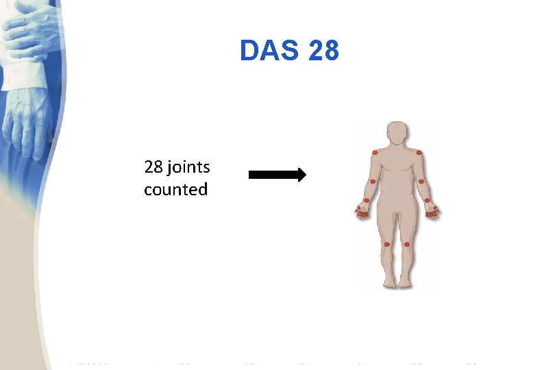 DAS 28 28 joints counted 