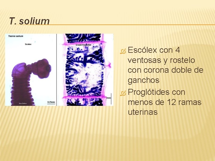 T. solium Escólex con 4 ventosas y rostelo con corona doble de ganchos Proglótides