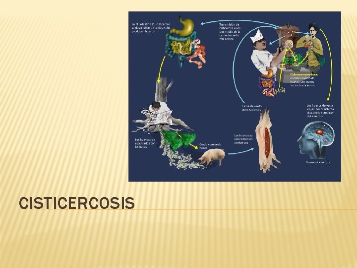 CISTICERCOSIS 