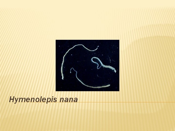 Hymenolepis nana 