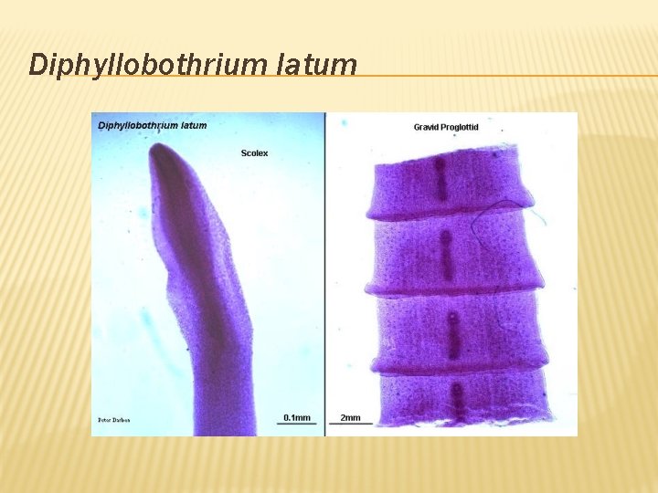 Diphyllobothrium latum 