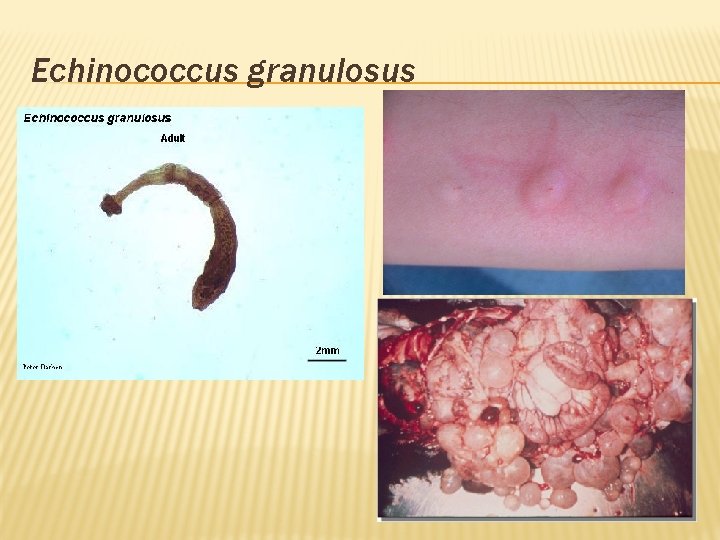Echinococcus granulosus 