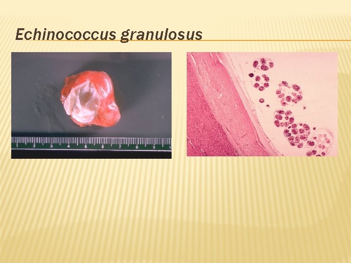 Echinococcus granulosus 