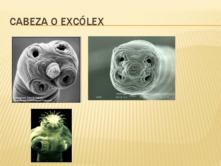 CABEZA O EXCÓLEX 