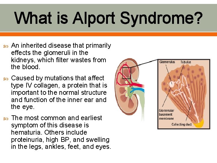 What is Alport Syndrome? An inherited disease that primarily effects the glomeruli in the