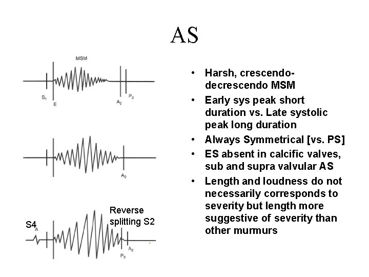AS S 4 Reverse splitting S 2 • Harsh, crescendodecrescendo MSM • Early sys AS S 4 Reverse splitting S 2 • Harsh, crescendodecrescendo MSM • Early sys