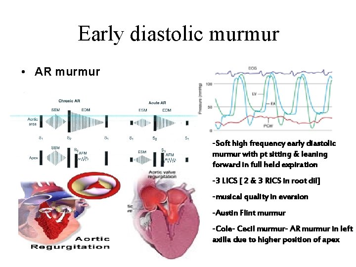 Early diastolic murmur • AR murmur -Soft high frequency early diastolic murmur with pt