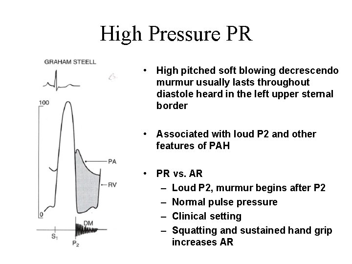 High Pressure PR • High pitched soft blowing decrescendo murmur usually lasts throughout diastole