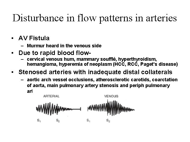 Disturbance in flow patterns in arteries • AV Fistula – Murmur heard in the