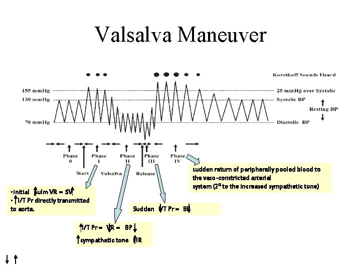 Valsalva Maneuver • initial pulm VR = SV • I/T Pr directly transmitted to
