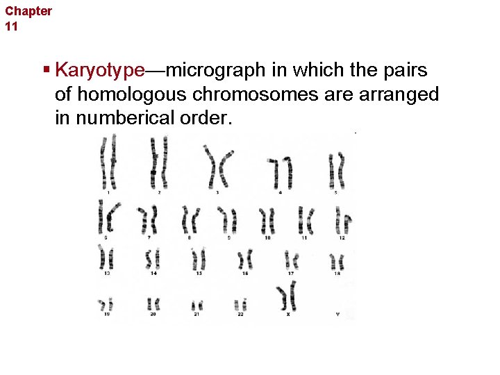 Chapter 11 Complex Inheritance and Human Heredity § Karyotype—micrograph in which the pairs of