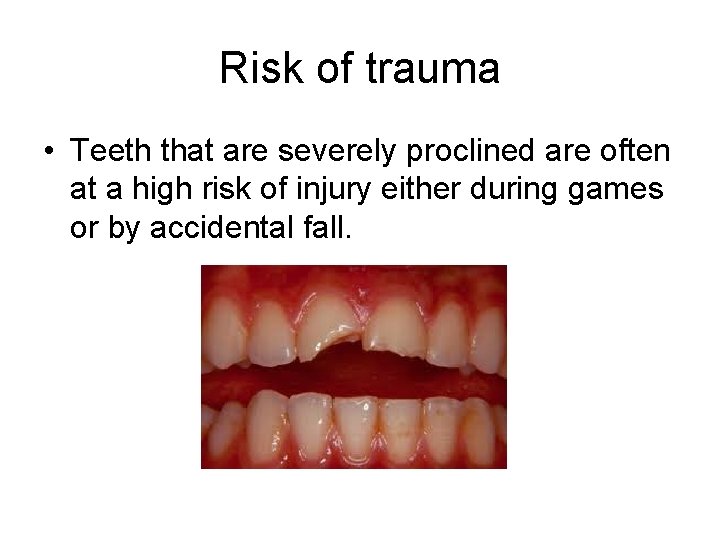 Risk of trauma • Teeth that are severely proclined are often at a high