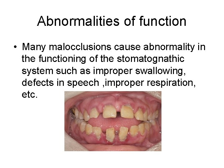 Abnormalities of function • Many malocclusions cause abnormality in the functioning of the stomatognathic