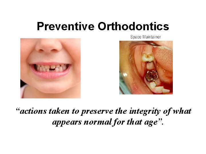 Preventive Orthodontics “actions taken to preserve the integrity of what appears normal for that