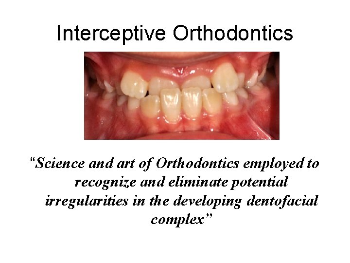 Interceptive Orthodontics “Science and art of Orthodontics employed to recognize and eliminate potential irregularities