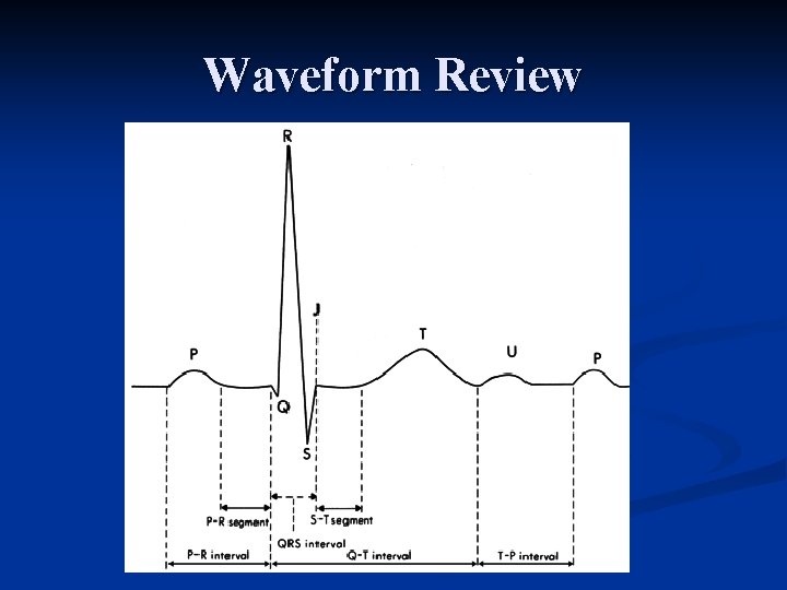 Waveform Review 