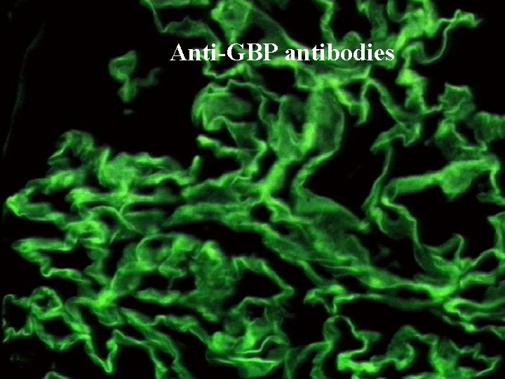 Anti-GBP antibodies Anti-GBP antibodies