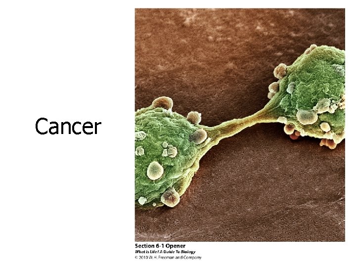 Cancer Cancer
