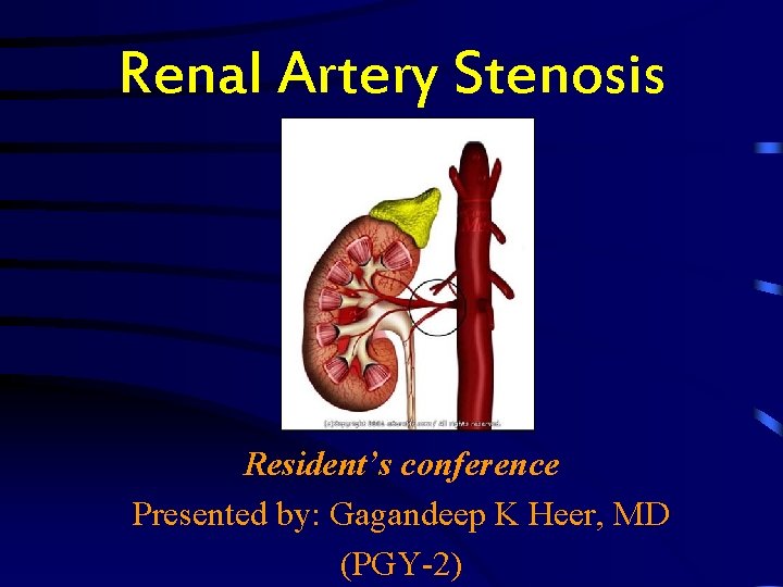 Renal Artery Stenosis Resident’s conference Presented by: Gagandeep K Heer, MD (PGY-2) 