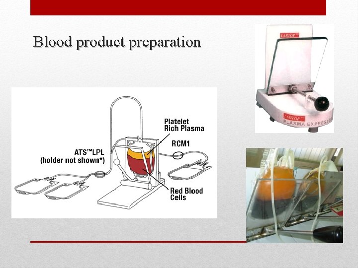 Blood product preparation 