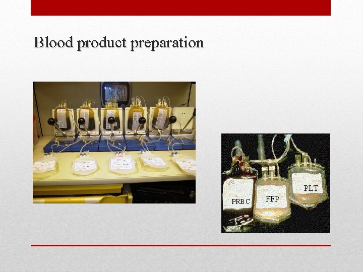 Blood product preparation PLT PRBC FFP 