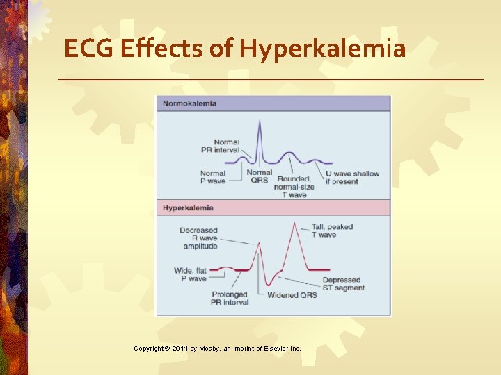 ECG Effects of Hyperkalemia Copyright © 2014 by Mosby, an imprint of Elsevier Inc.