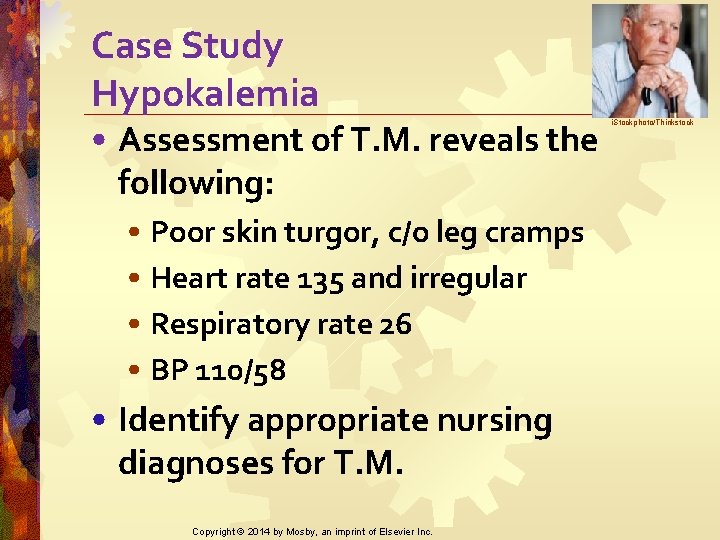 Case Study Hypokalemia • Assessment of T. M. reveals the following: • Poor skin