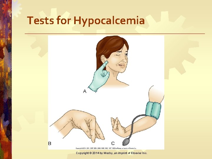 Tests for Hypocalcemia Copyright © 2014 by Mosby, an imprint of Elsevier Inc. 