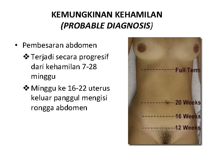 KEMUNGKINAN KEHAMILAN (PROBABLE DIAGNOSIS) • Pembesaran abdomen v Terjadi secara progresif dari kehamilan 7