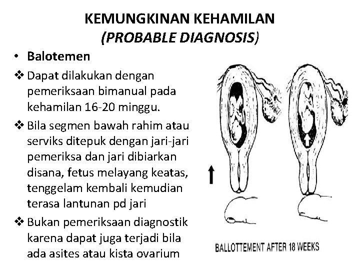 KEMUNGKINAN KEHAMILAN (PROBABLE DIAGNOSIS) • Balotemen v Dapat dilakukan dengan pemeriksaan bimanual pada kehamilan