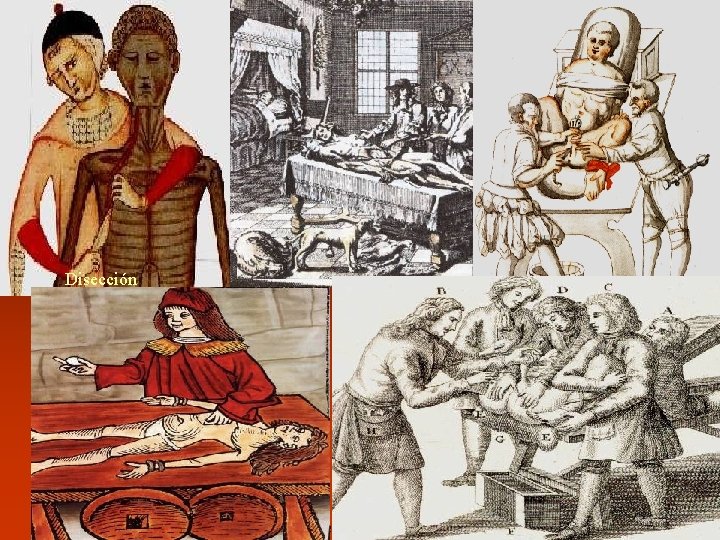 Disección Operaciones urológicas 