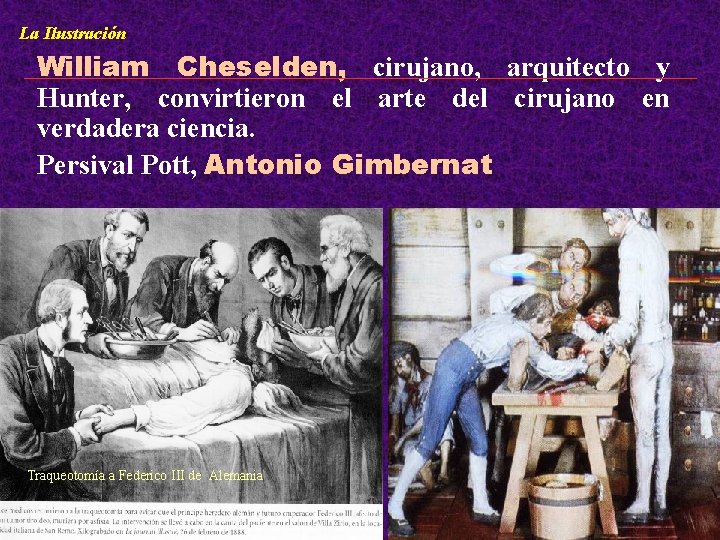 La Ilustración William Cheselden, cirujano, arquitecto y Hunter, convirtieron el arte del cirujano en