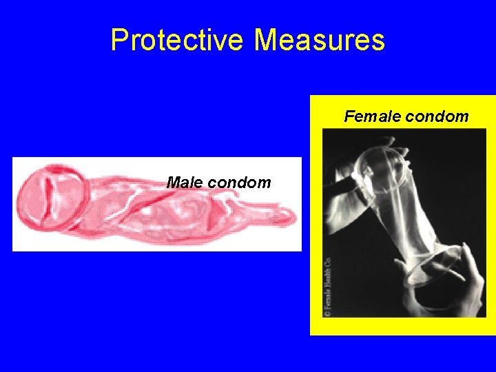 Protective Measures Female condom Male condom 