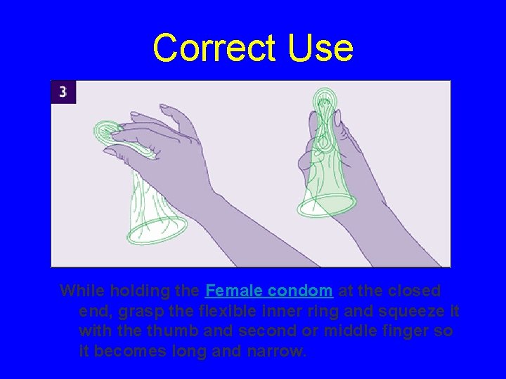 Correct Use While holding the Female condom at the closed end, grasp the flexible