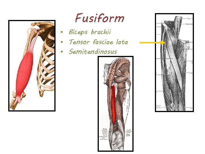 Fusiform • Biceps brachii • Tensor fasciae lata • Semitendinosus 
