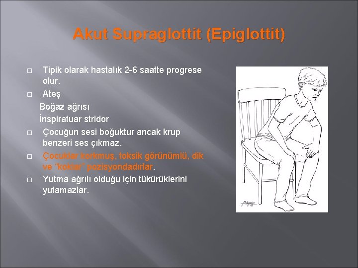 Akut Supraglottit (Epiglottit) Tipik olarak hastalık 2 -6 saatte progrese olur. Ateş Boğaz ağrısı