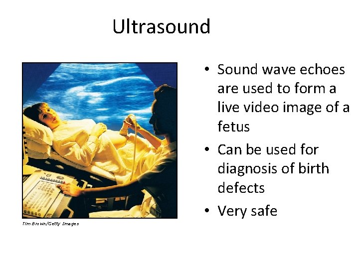 Ultrasound • Sound wave echoes are used to form a live video image of
