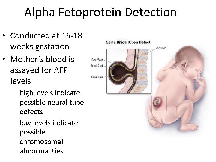 Alpha Fetoprotein Detection • Conducted at 16 -18 weeks gestation • Mother’s blood is