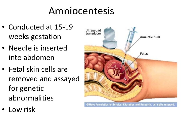 Amniocentesis • Conducted at 15 -19 weeks gestation • Needle is inserted into abdomen