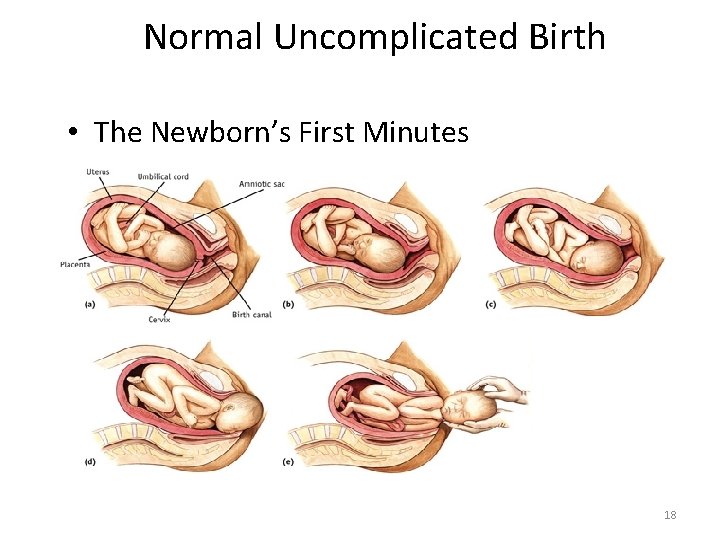 Normal Uncomplicated Birth • The Newborn’s First Minutes 18 