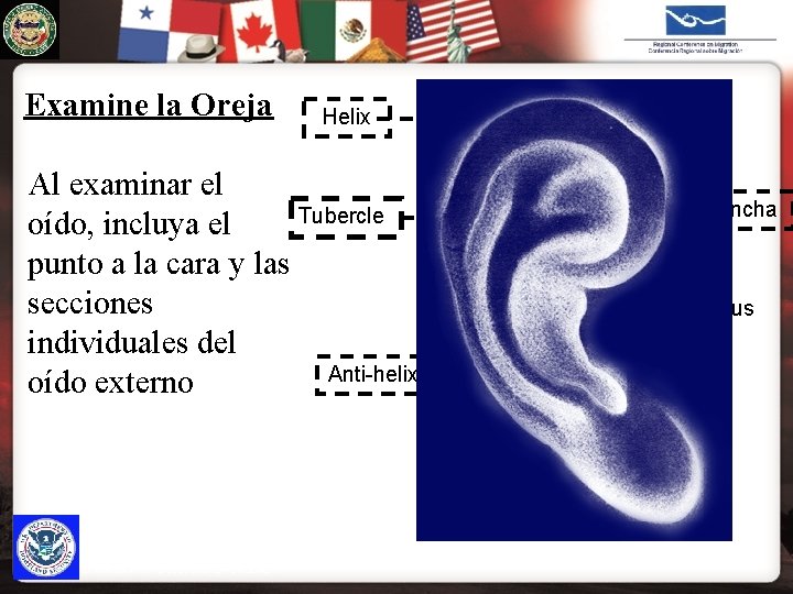 U. S. IMMIGRATION & CUSTOMS ENFORCEMENT Examine la Oreja Helix Al examinar el Tubercle