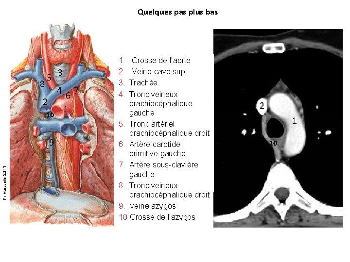 Quelques pas plus bas 5 3 8 4 7 6 2 1 10 Pr