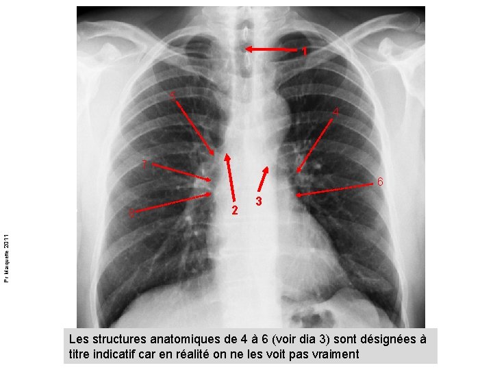 1 5 4 7 6 3 Pr Marquette 2011 8 2 Les structures anatomiques