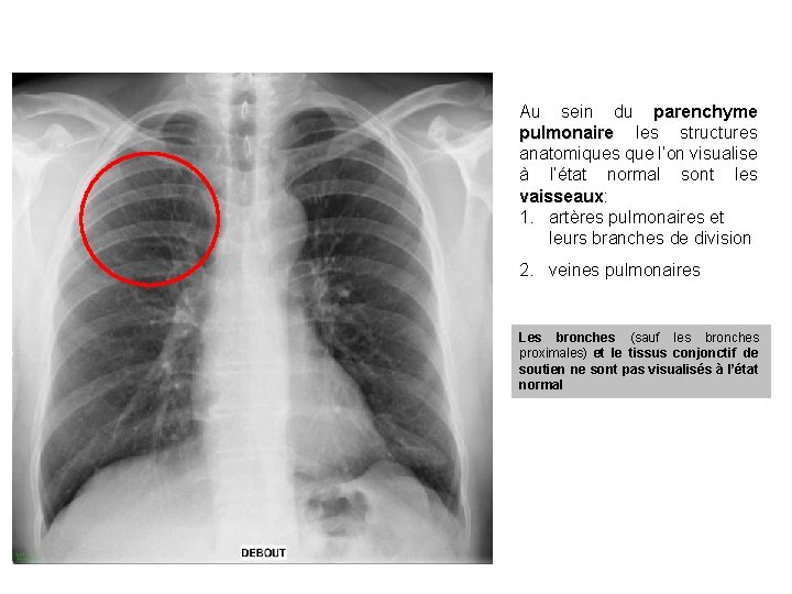 Au sein du parenchyme pulmonaire les structures anatomiques que l’on visualise à l’état normal