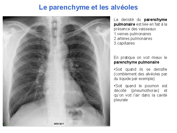 Le parenchyme et les alvéoles La densité du parenchyme pulmonaire est liée en fait