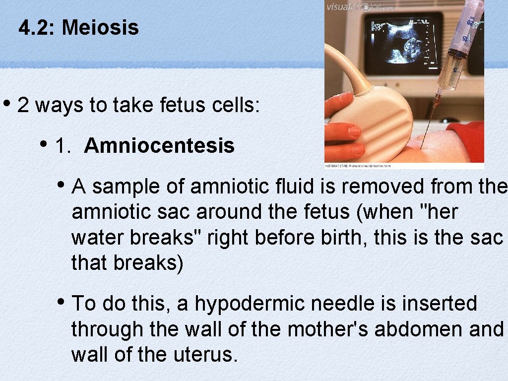 4. 2: Meiosis • 2 ways to take fetus cells: • 1. Amniocentesis •