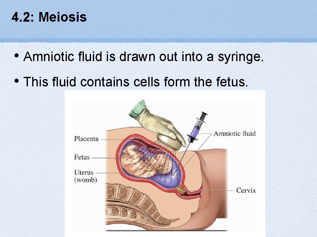 4. 2: Meiosis • Amniotic fluid is drawn out into a syringe. • This